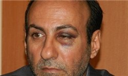 یاسوج، پزشک، ضرب و شتم، خامی، باشت